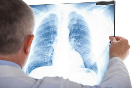 Lungenarzt - Pneumologe